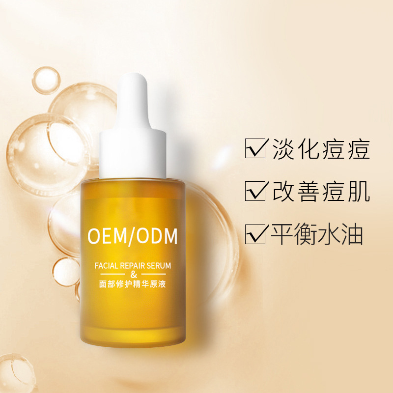 玉婕_祛痘精华原液OEM