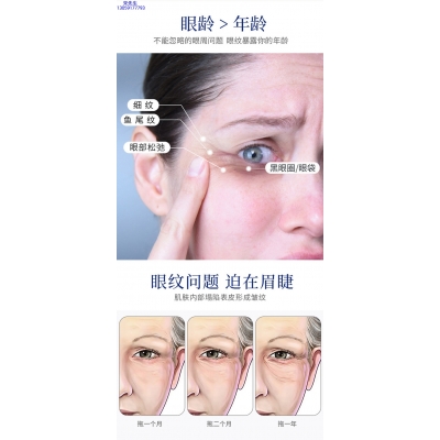 玉婕_美容院玻尿酸微针眼贴